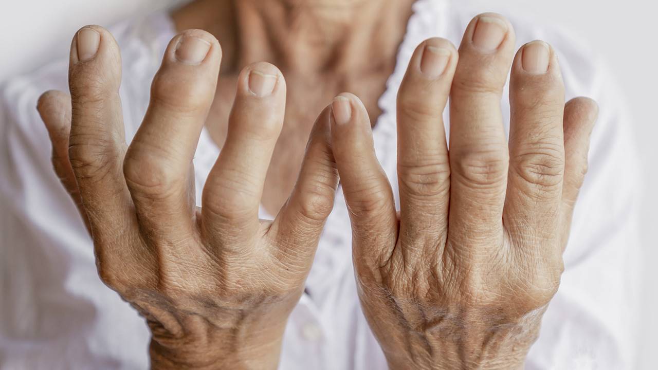 Artrosis de mano - 5 ejercicios recomendados