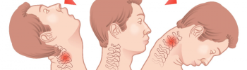 latigazo cervical latigazo cervical