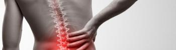 Sacroileítis, qué es, causas y tratamiento mediante fisioterapia Sacroileítis, qué es, causas y tratamiento mediante fisioterapia
