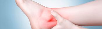 Tendinitis aquilea Tendinitis aquilea