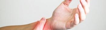 Tendinitis de Quervain y su tratamiento mediante la electrólisis percutánea intratisular- EPI. Tendinitis de Quervain y su tratamiento mediante la electrólisis percutánea intratisular- EPI.