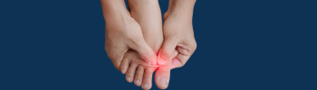 Diferencia entre metatarsalgia aguda y crónica y su tratamiento fisioterapéutico