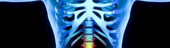 Estimulación eléctrica transcutánea (TENS) el tratamiento de la hernia discal lumbar Estimulación eléctrica transcutánea (TENS) el tratamiento de la hernia discal lumbar