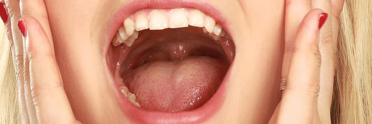 Bruxismo: 5 ejercicios para mejorar tu tensión en la mandíbula