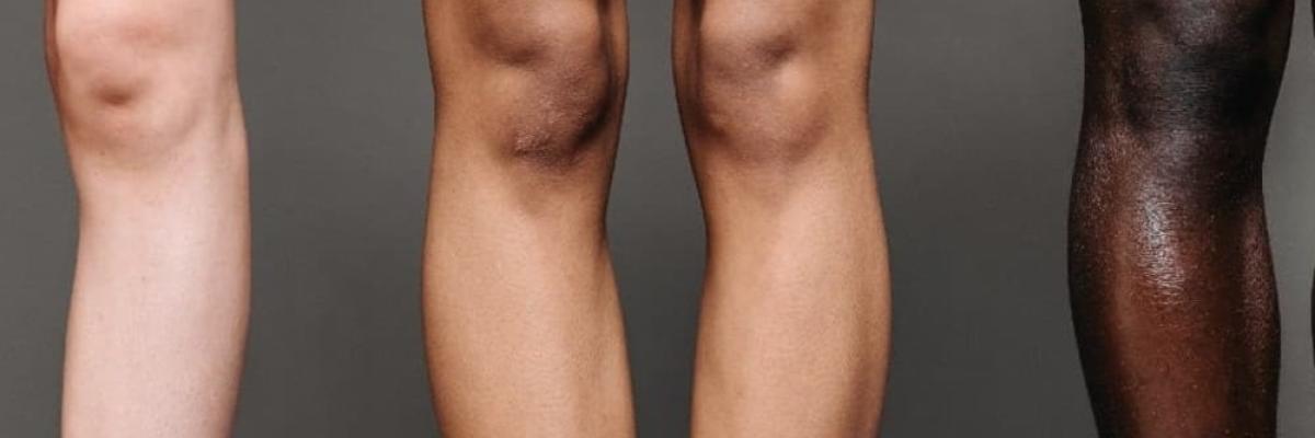 Tendinitis de la pata de ganso: causas, síntomas y tratamiento fisioterapéutico Tendinitis de la pata de ganso: causas, síntomas y tratamiento fisioterapéutico