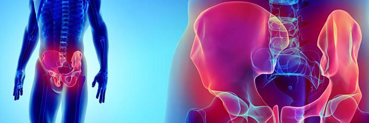 Tratamiento preventivo para la Osteopatía de Pubis - FisioClinics Bilbao