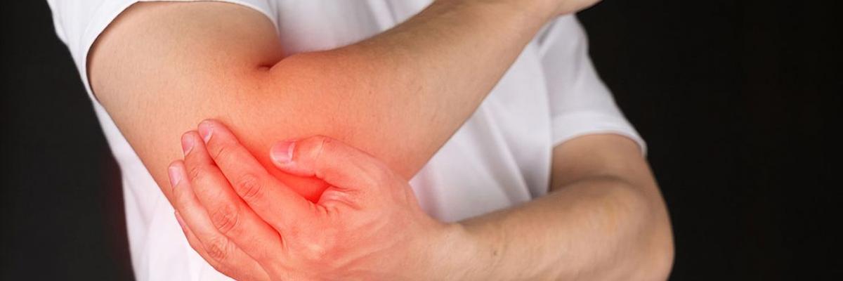  Epicondilitis o codo de tenista