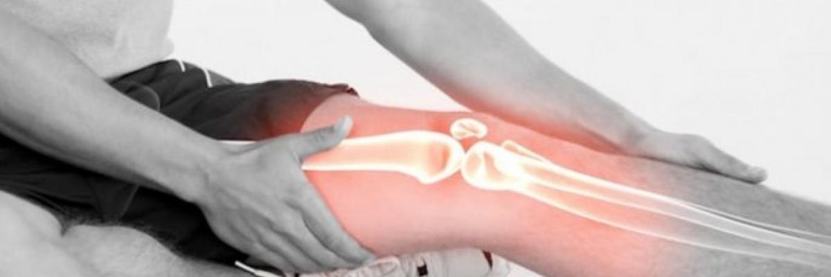 Fibrosis muscular de los aductores